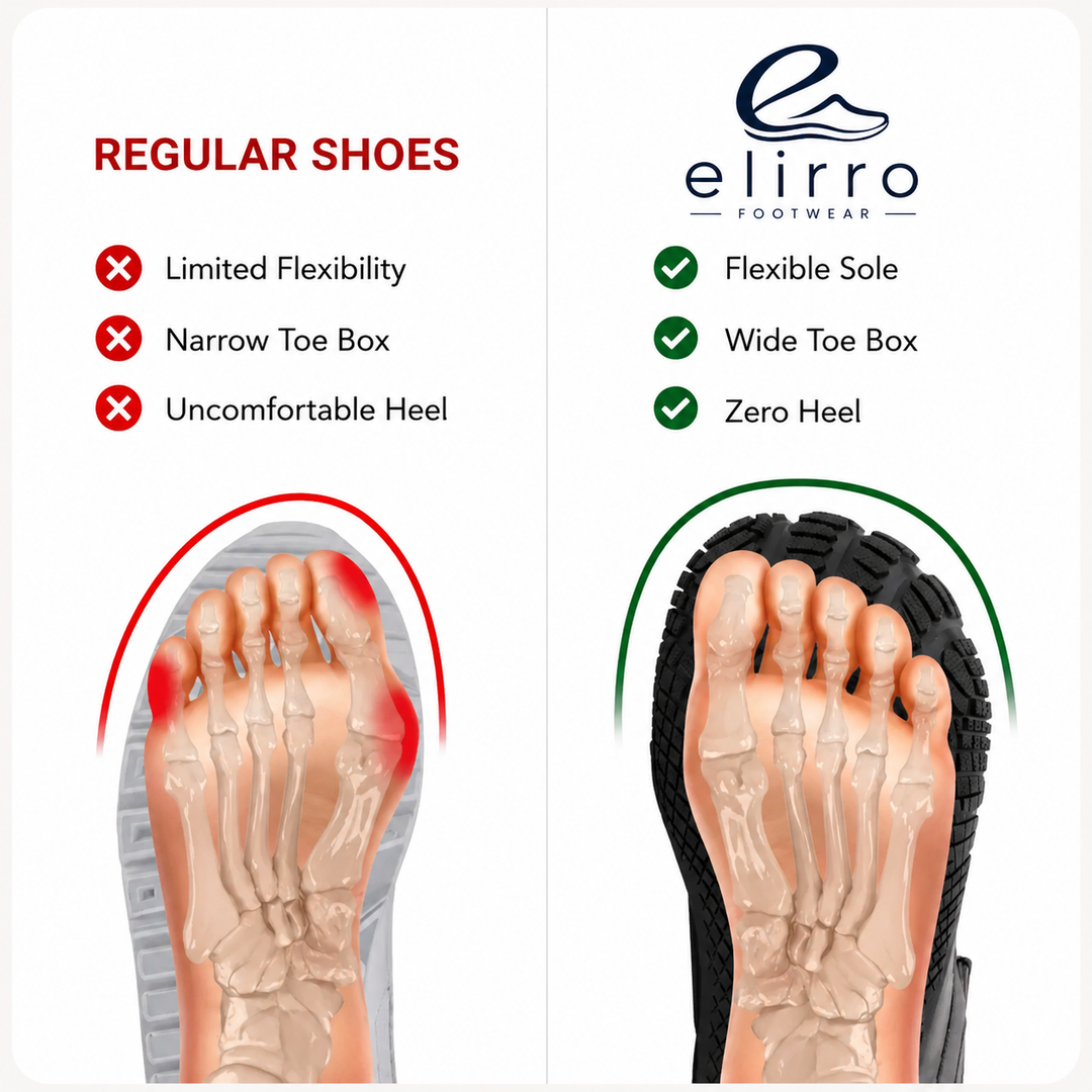 Foot alignment comparison